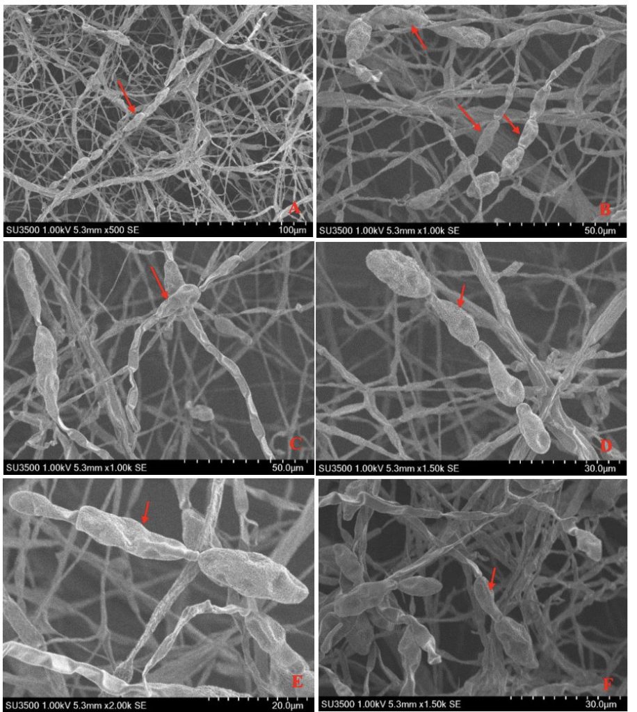hình thái nấm gây bệnh đốm nâu trên chanh dây